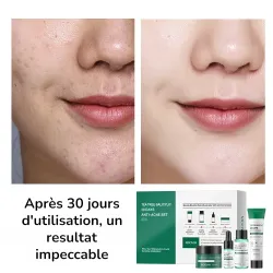 résultat après 30 jours d'utilisation du coffret 3 jours MOOYAM