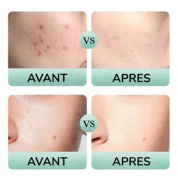 resultats avant-après du coffret 30 jours MOOYAM