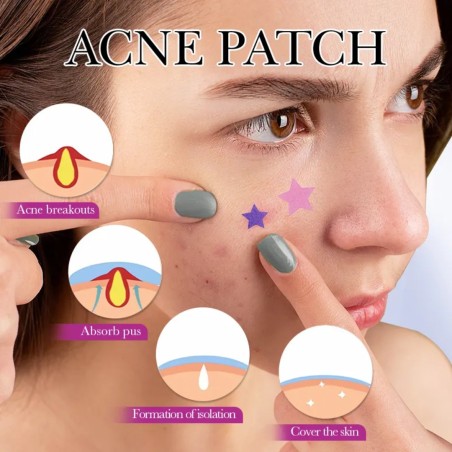 Patchs anti-acné