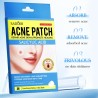 Patchs anti-acné